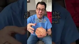 Brain Pulses during Brain Surgery 🧠 #doctor #surgeon #shorts