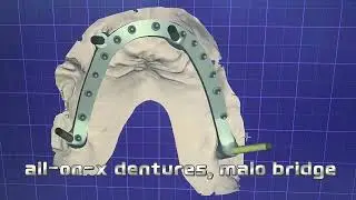 Join our dental design team for quality and excellence China Dental Lab