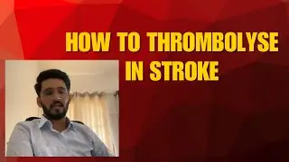 How to thrombolyse in stroke.  #alteplase #tenecteplase #thrombosis #thrombolysis #lysis #stroke