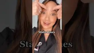 Can Botox treat static lines? #botox #wrinkles #tampa #botoxtreatment