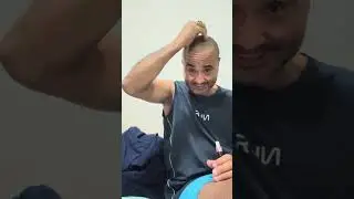 Conhece algu&eacute;m careca ou com queda de cabelo #careca #envyhair #quedadecabelo 