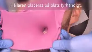 Applicering av Kofferdam p&aring; molar