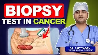 Biopsy Test क्या है और कैसे होता है? Cancer मे Biopsy Test क्यूँ जरूरी है | Dr. Ajit Yadav