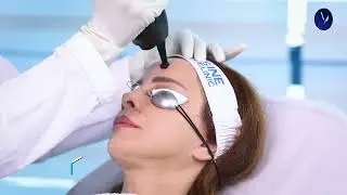 10 YEARS YOUNGER WITH OUR FRACTIONAL CO2 LASER (eCO2 LASER FULL FACE & NECK SKIN RESURFACING)
