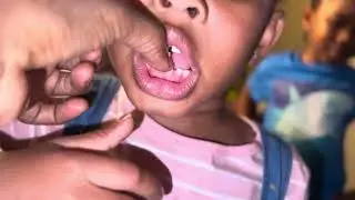 Nila has a wiggly Tooth !!!