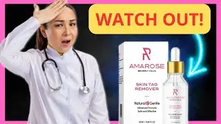 Amarose Skin Tag Remover REVIEW |  amarose skin tag remover HOW TO APPLY |  amarose skin tag remover