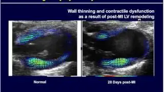 Webinar: Cardiovascular Research with Prof. Brent French - VisualSonics