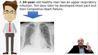 Internal Medicine CME USMLE Fever Chest Pain Heart Failure URTI Diagnosis (Q) محاضرات باطنة :