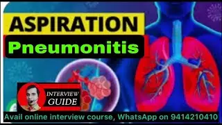 Aspiration pneumonitis | AMC interview questions | Army Doctor Interview | Interview Guide