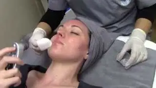 Watch a Chemical Peel Treatment at Seiler Skin!