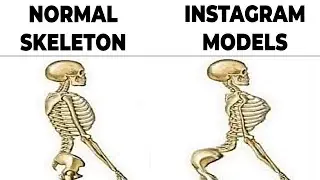 Memes That Teach Me Anatomy