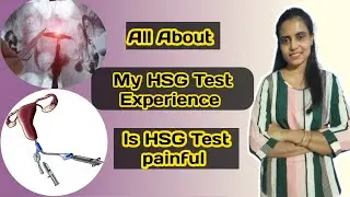 HSG Test || Fertility Test || My HSG Test Experience ||