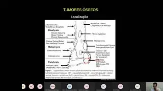 Tumores ósseos: como interpretar