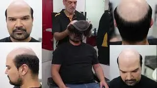 The Hair Crew - Non-surgical hair replacement