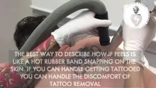 Laser Tattoo Removal Auckland NZ