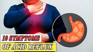 Top 10 Symptoms of Acid Reflux&mdash; Top 10 Wizard