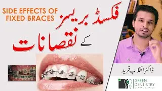 Side Effects of Fixed Braces | How to Deal with Problems with Braces | Dr. Inqalab | Urdu | Hindi