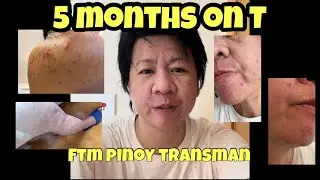 5 months on T (ftm pinoy transman update)