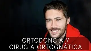 La sonrisa de Sergio: tratamiento de combinado de ortodoncia y cirugía ortognática