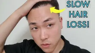 TOP 3 THINGS TO AVOID TO SLOW HAIR LOSS!