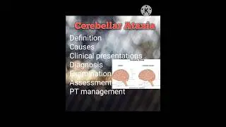 | Cerebellar Ataxia easy details Notes | Neuro Assessment and management | important topic 📝