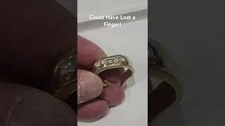 Restoring a Crushed Ring: The Ultimate Ring Repair