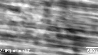 Simultaneous radiography and diffraction topography imaging