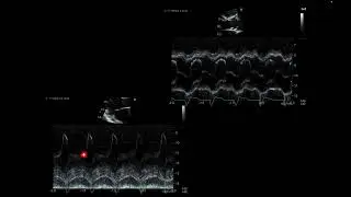 M-mode imaging