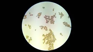 Puccinia graminis ex Festuca arundinacea