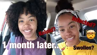 Smiley Piercing 1 Month  Update | Why I Took It Out