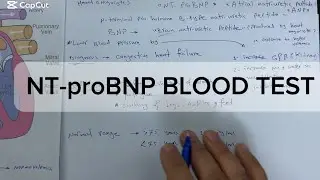 NT-proBNP blood test