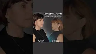 𝗔𝗿𝗹𝗲𝗻𝗲&rsquo;𝘀 𝗙𝗮𝗰𝗶𝗮𝗹 𝗥𝗲𝗷𝘂𝘃𝗲𝗻𝗮𝘁𝗶𝗼𝗻 𝗝𝗼𝘂𝗿𝗻𝗲𝘆