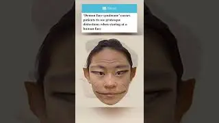 Here&rsquo;s what human faces look like to people with prosopometamorphopsia AKA &lsquo;demon face syndrome&rsquo; 😳