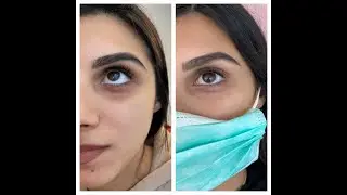 CC EYE Treatment / Permanent Concealer Berlin