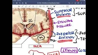 Stroke:-Arterial localization part 1