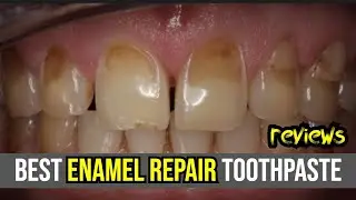 🦷 Best Enamel Repair Toothpaste Review 2024: Sensodyne, Crest, & ARM & Hammer! 🌟
