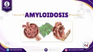 Amyloidosis 🧬Types, Pathogenesis & Clinical Correlation | General Pathology USMLE Step 1 & NEET PG