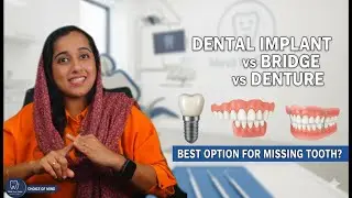 Dental Implant, Bridge or Partial Denture? Best Option for a Missing Tooth