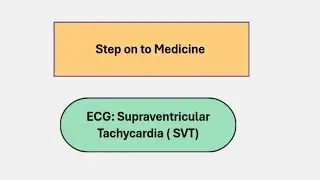 Supraventricular Tachycardia(SVT) ECG in Bangla with interpretation and Treatment 