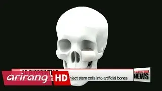 3D bioprinter prints artificial bones for medical purposes