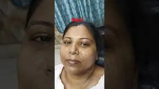 skin health improvement #youtubeshorts #brightskin #skincare
