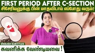 First Period After C-Section - சிசேரியனுக்கு பின் முதல் மாதவிடாய் எப்போது வரும்?