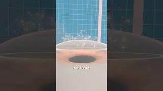 How Lasik Surgery Works 🤔 Surgeon Reacts