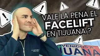 Turismo Est&eacute;tico a M&eacute;xico: &iquest;Vale la Pena el &lsquo;Facelift&rsquo; en Tijuana?