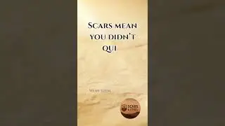 Scars Mean You Didn&rsquo;t Quit #Resilience #StrengthMindset #Survival