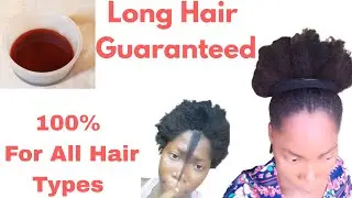 &rdquo;Natural Hair Remedy For Hair Loss, Bald Spots and Thinning Edges
