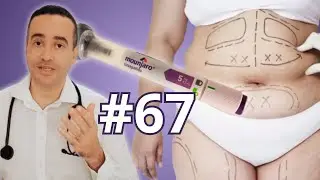 #67 Mounjaro: Lipodystrophy after Plastic Surgery [My Experience]