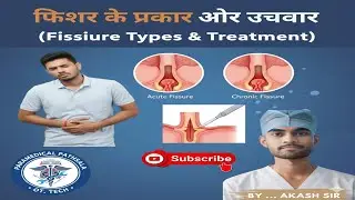 FissurePoicl #FissurePoint #Anatomy #MedicalStudents #ParamedicalStudy #NursingStudy #AnatomyLecture