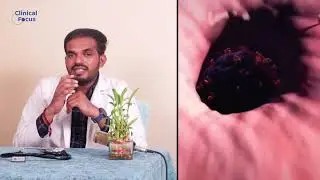 Why TT (tetanus) injection given after injury || Explained by Dr.Koteswararao || clinical focus