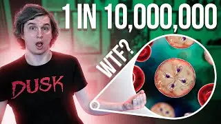 Health Update: Babesia Infection with 1 in 10,000,000 odds